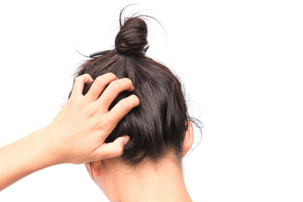 Flaky Scalp Avoid Quarantine Hair Disaster | Avalanche Salon & Spa